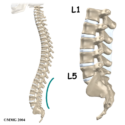 Lumbar Disk Herniation Anatomy